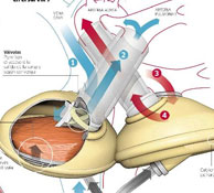 Jarvik 7, the first artificial heart